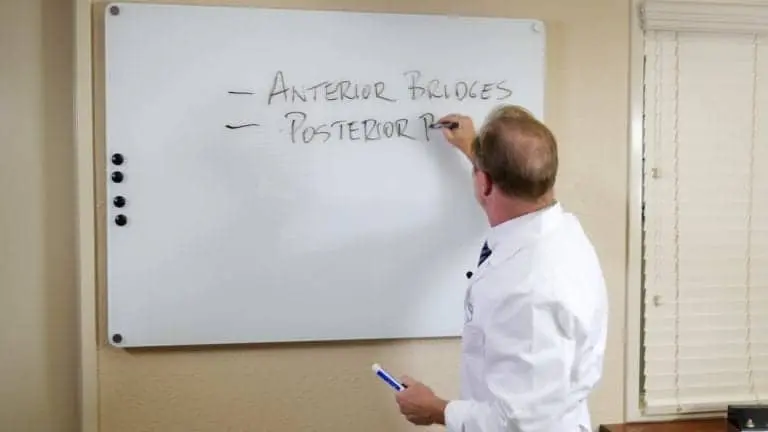 All Ceramic Layered Crown And Bridges