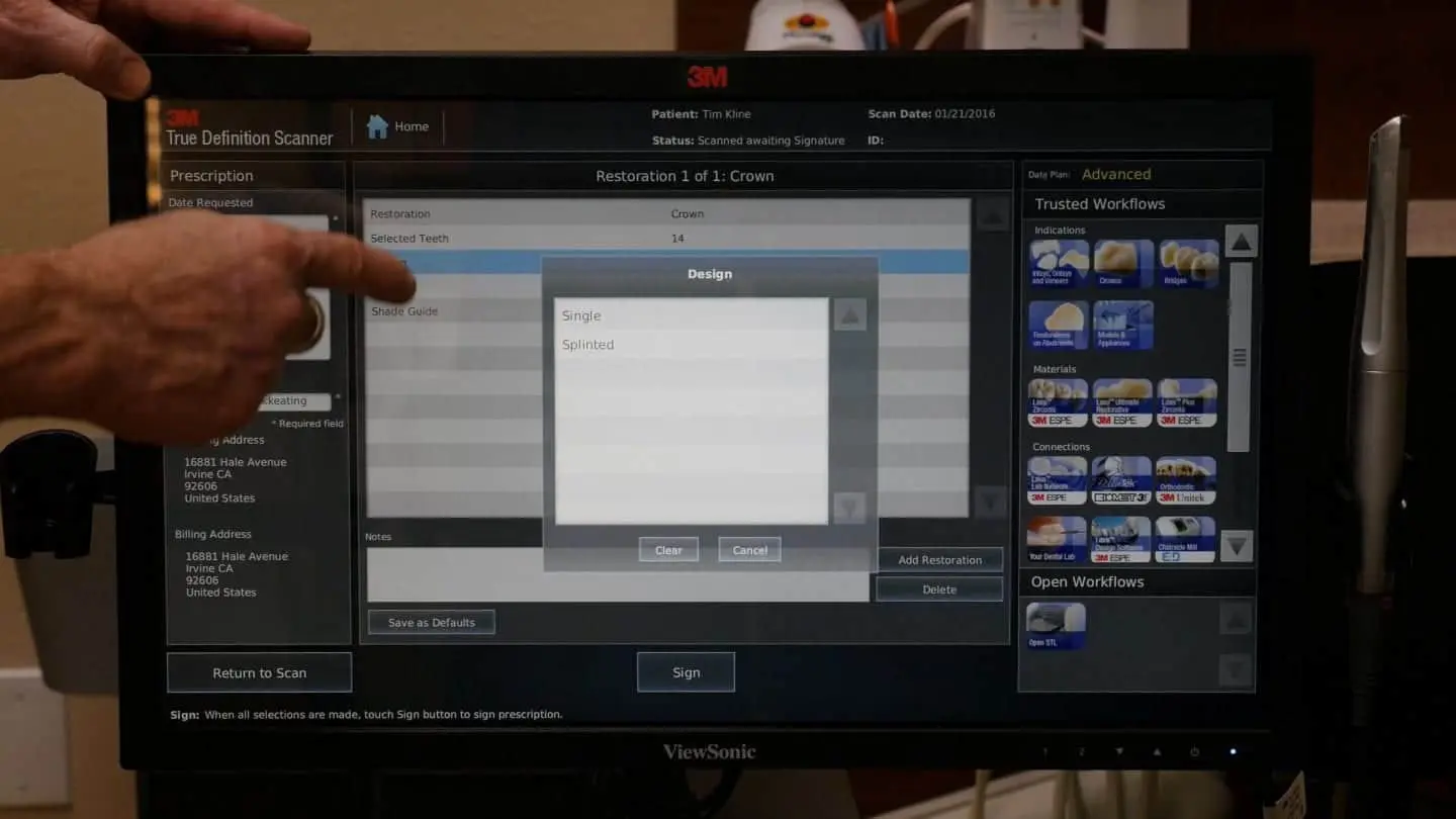 Definition Digital Scanner Workflow Video