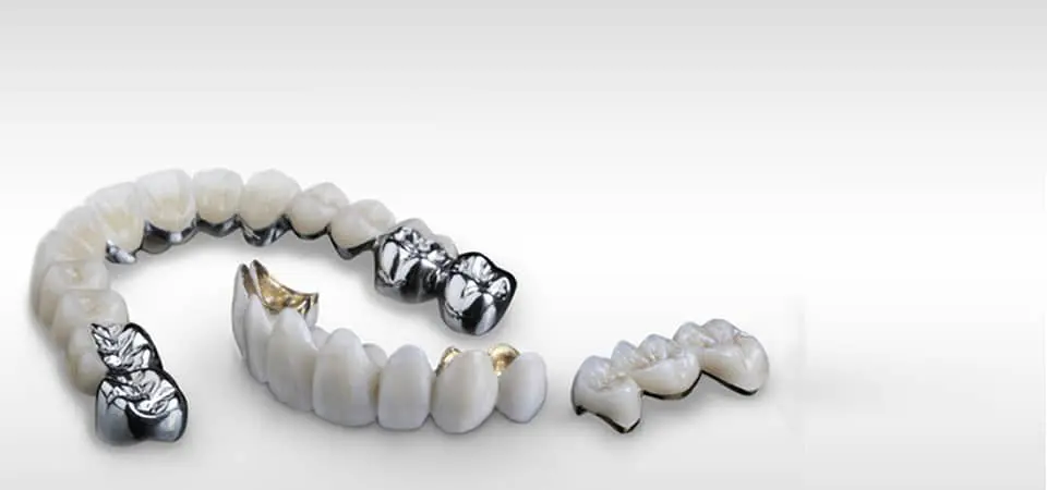 pfm_crowns_bridges_lab_960x450x1