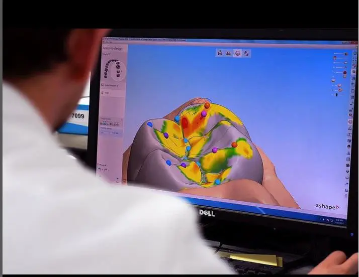 3shape design software