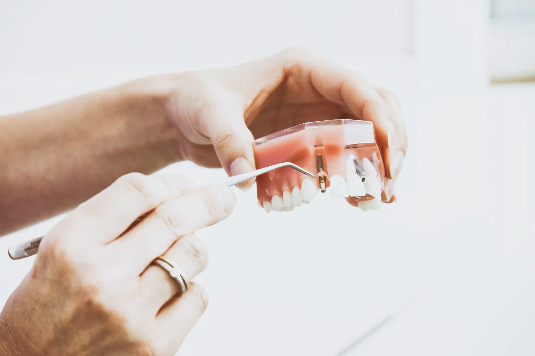 Dental technician manipulating a model with a implant on it