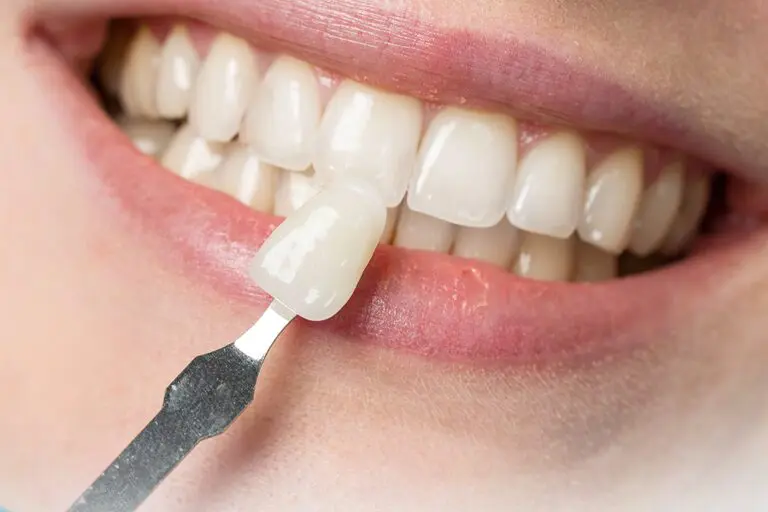 lithium disilicate crowns