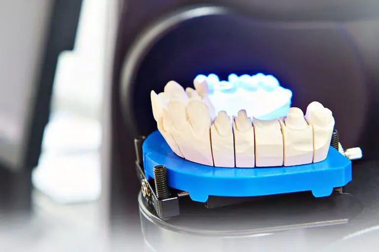 digital impressions in dentistry