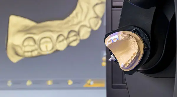 Dental lab digital workflow