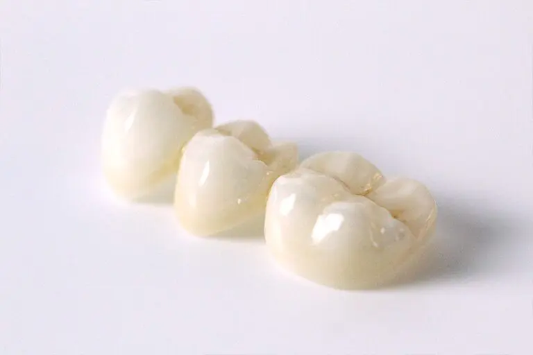 KDZ zirconia bridge