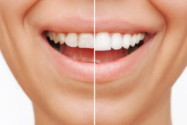 dental crown preparation