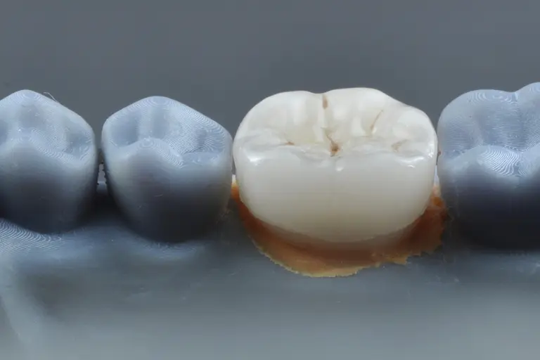 dental crowns