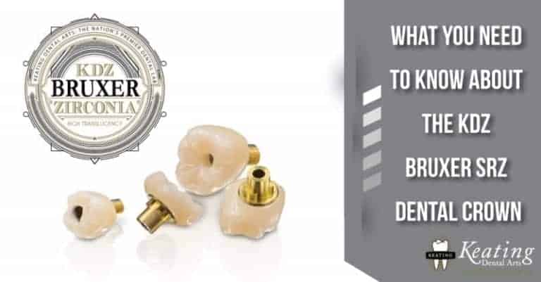 What You Need to Know About the KDZ Bruxer SRZ Dental Crown