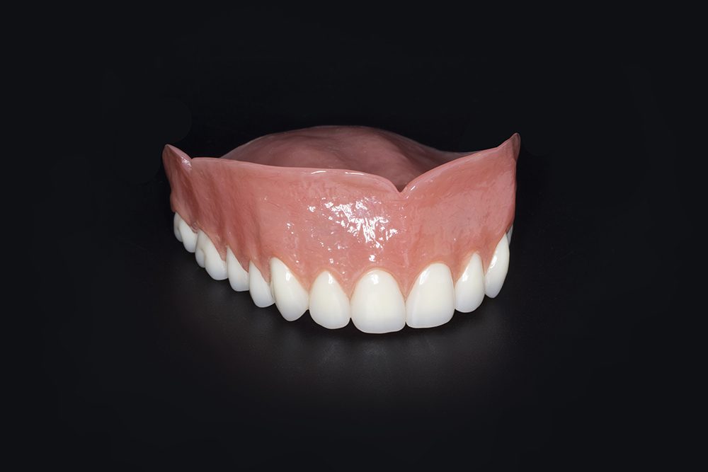 KDL Ultra Premium Denture - Ivocap® Injected Acrylic Dentures